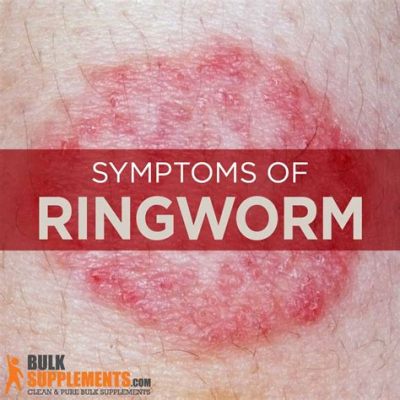 Can You Swim with Ringworm NHS: Exploring the Myths and Realities